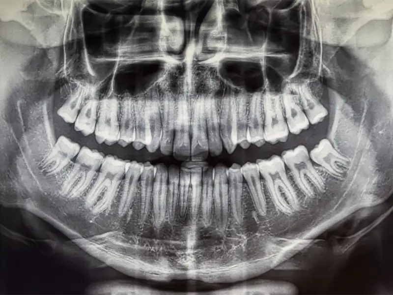 Gualini - Diagnostica Gualini - Diagnostica