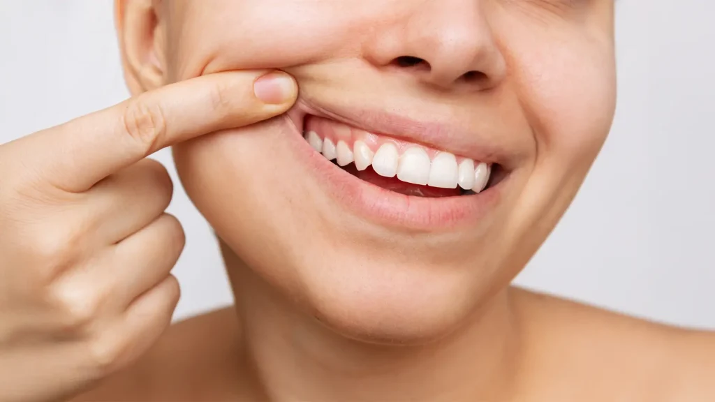 Articolo Parodontologia