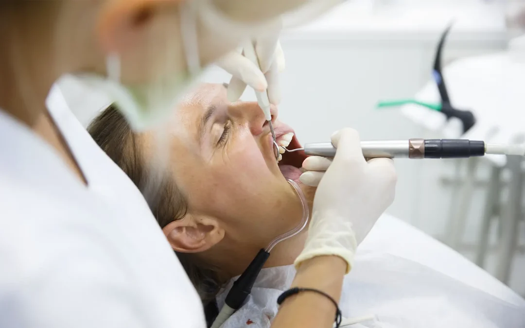 Come curare la parodontite: metodi efficaci per ogni stadio della malattia