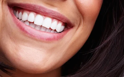 Cos’è l’estetica dentale e quali vantaggi offre
