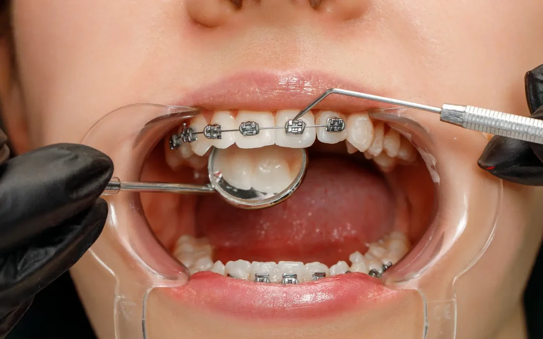 Trattamenti ortodontici